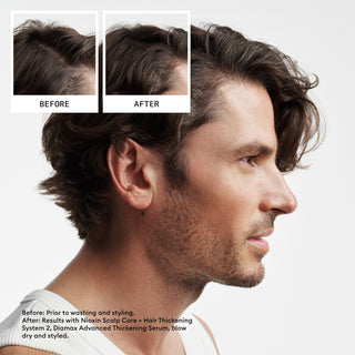 Nioxin System Kit 2 Haircare Gift Set (worth £117)