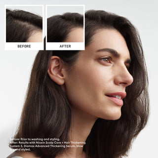 Nioxin System Kit 3 Haircare Gift Set (worth £117)